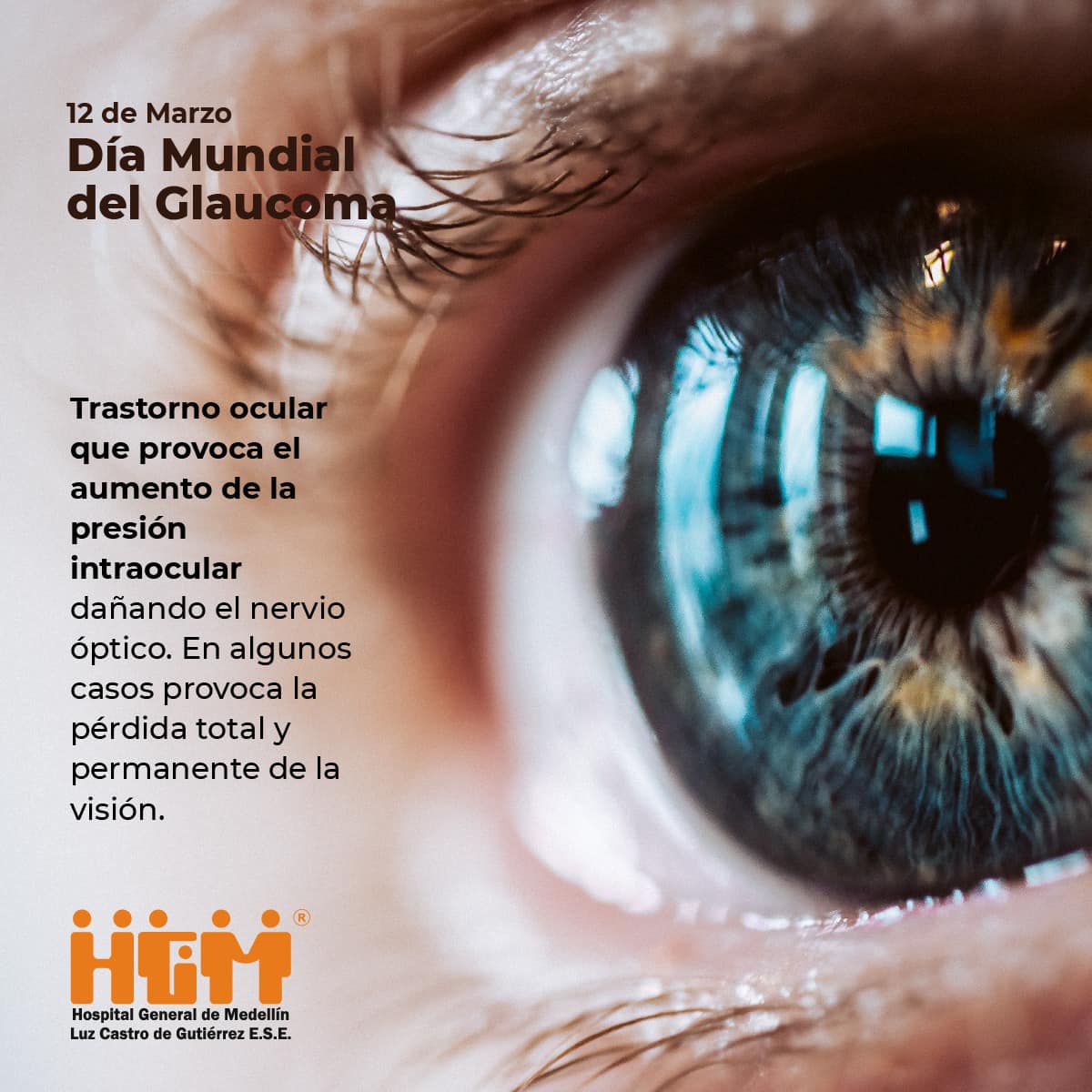 Día Mundial del Glaucoma 